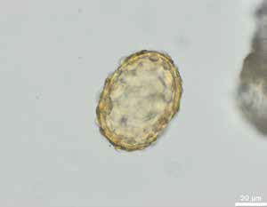 Huevo de Ascaris lumbricoides con su cubierta mamelonada, hallado en el individuo articulado del CE48 (López-Gijón et al., 2024)